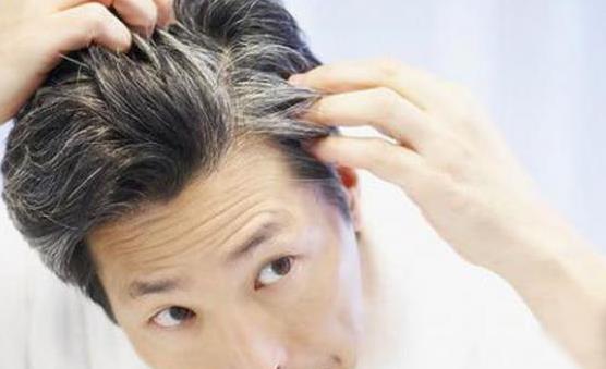 白头发让人苦恼 百合银耳饮能有效黑发润发-很美的