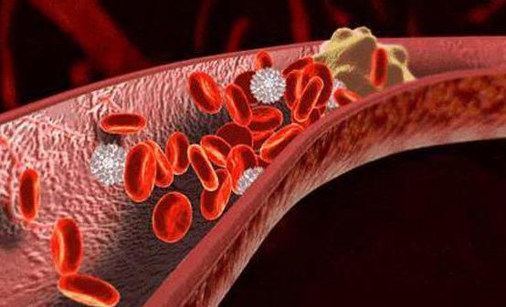 能软化血管的12种食物 让血管恢复正常-很美的