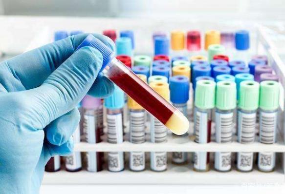 上班途中怎么预防被传染新冠病毒肺炎?挤地铁会被传染吗?