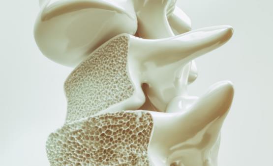 骨质疏松的认知误区你中了没 骨质疏松的饮食保健-很美的