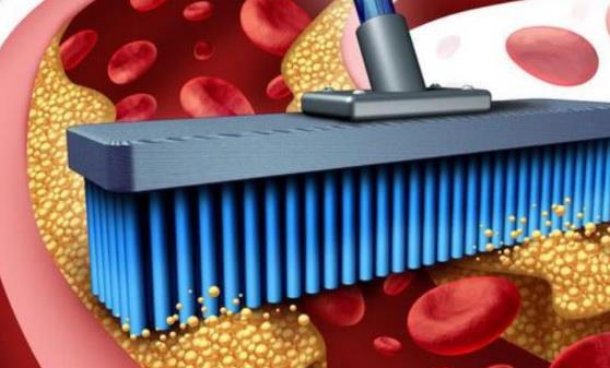 蔬菜清理血管垃圾 食疗调理效果最佳-很美的