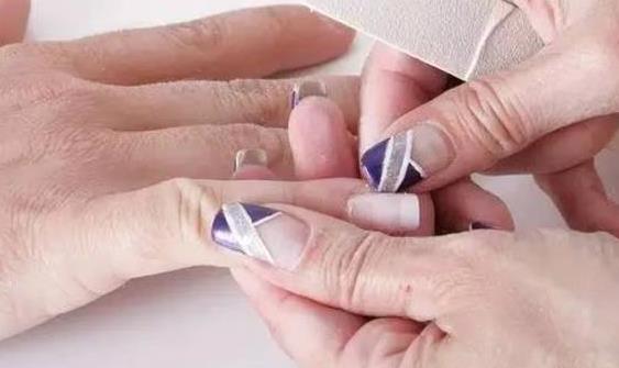 甲沟炎竟是自己作出来的 甲沟炎预防成了关键-很美的