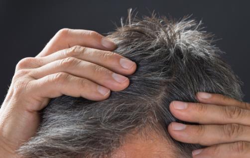 导致头发变白的坏习惯 小习惯就能拥有一头乌黑秀发-很美的