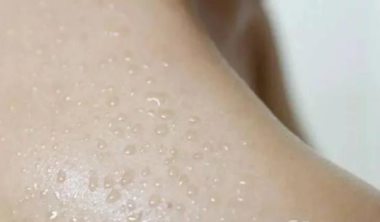 经常出汗也是病 4种疾病可引起多汗症