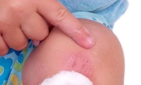 一不留神宝宝受伤了 父母镇定处理好方法推荐-很美的