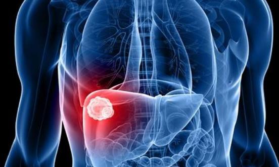 男性最需要去做的就是养肝 选对正确的具有护肝功效的食物-很美的