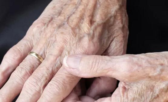 老年斑并不是老年人的专利 预防和延缓老年斑发生的食物-很美的