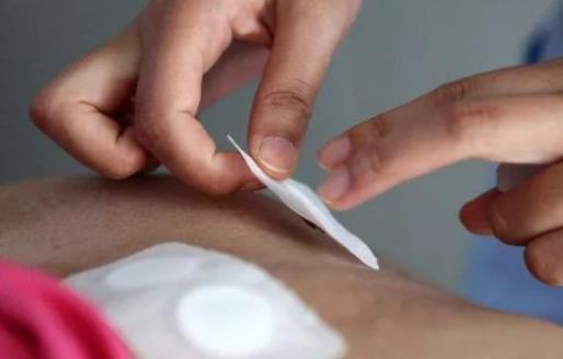 ​儿童三伏贴贴满三年还要贴吗 三伏贴儿童几岁可以贴