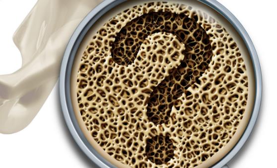 骨质疏松的常见认知误区 看看你有没有中招-很美的