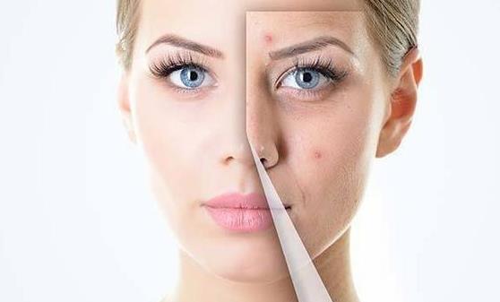 女人湿气种容易形成肥胖 排湿气注意饮食要多运动-很美的