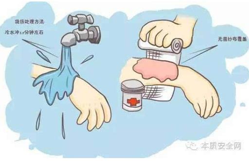 阻止继续烧伤只要18秒-很美的