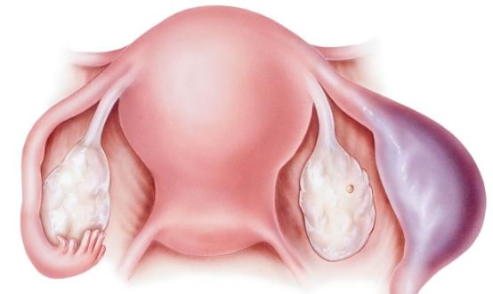 什么原因会引起宫外孕 这6个问题教你预防宫外孕-很美的