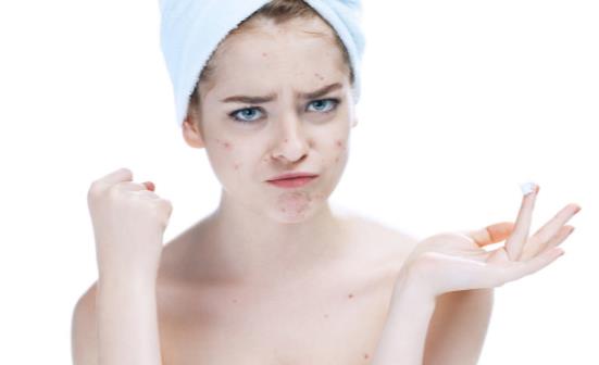 下巴老长粉刺怎么办 祛除白头粉刺的生活小秘方-很美的