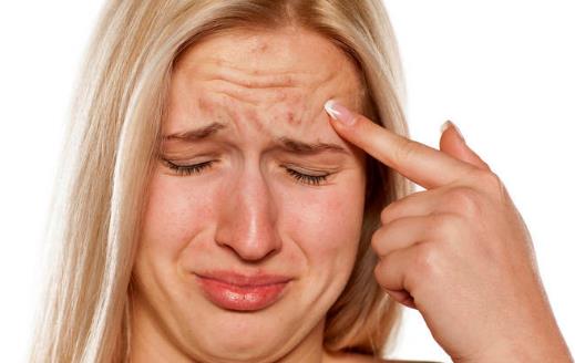 肌肤长痘痘 祛痘10大误区应避免-很美的