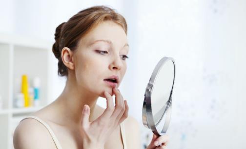 下巴长痘是什么原因造成的 天然祛痘祛印的方法分享-很美的