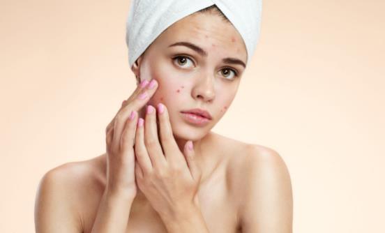 为何脸上容易长出痘痘 不同部位的痘痘有什么去除的好方法-很美的