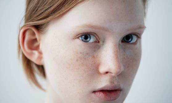 经常化妆 脸上长斑怎么办?