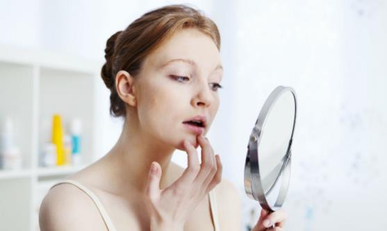 下巴为何反复长痘 下巴长痘的护理要点请记牢-很美的