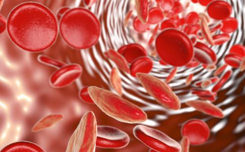 气色差是吃出来的 脸黄气色差的原因你占了几条-很美的