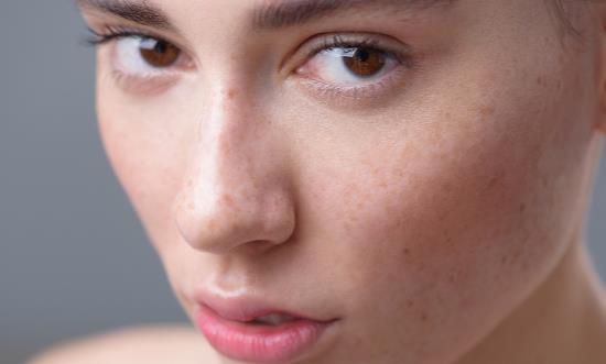 经常化妆 脸上长斑怎么办?