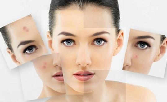 祛痘印小窍门学起来 帮助女性恢复俏佳人的本色-很美的