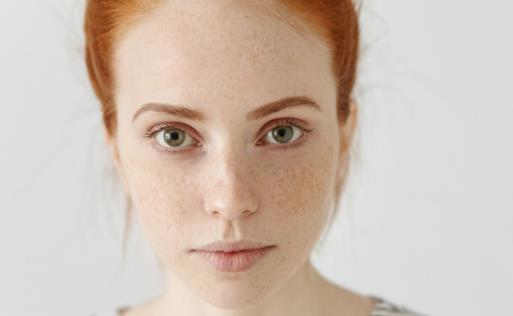 内外兼治祛除黄褐斑 去除黄褐斑食疗方法-很美的