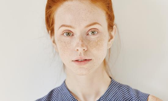 激光祛斑会不会反弹 适合激光祛斑的人群