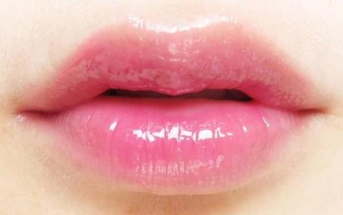 嘟嘟唇术后注意事项 漂亮的嘟嘟唇要结合自身基础-很美的