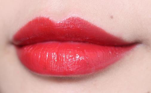 嘟嘟唇术后注意事项