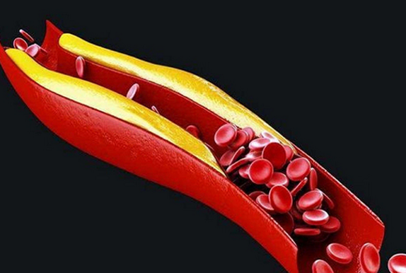 10种人不宜喝酸奶