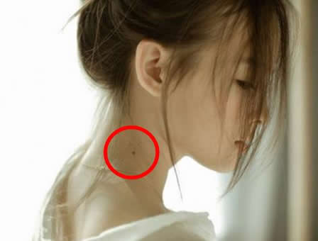 女人脖子右侧有痣图解