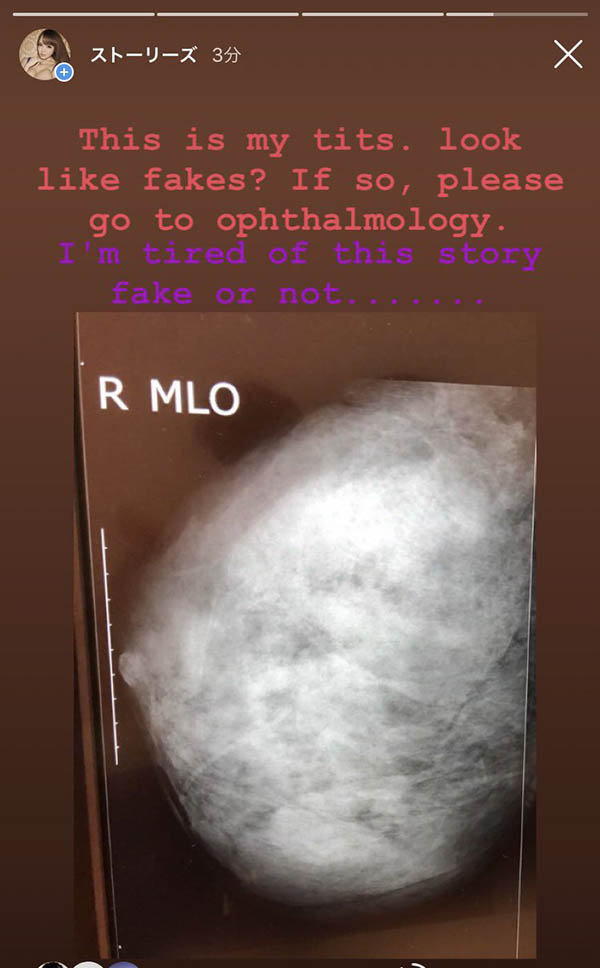 AV第一乳霸《Hitomi》精选作品推荐介绍及封面预览